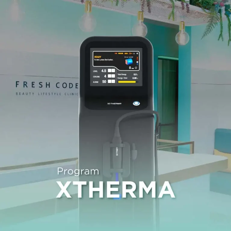 XTherma เครื่องยกกระชับผิวด้วยเทคโนโลยี Monopolar RF โดยแพทย์ผู้เชี่ยวชาญที่ Fresh Code Clinic สำหรับยกกระชับกรอบหน้า ลดความหย่อนคล้อย และกระตุ้นคอลลาเจน