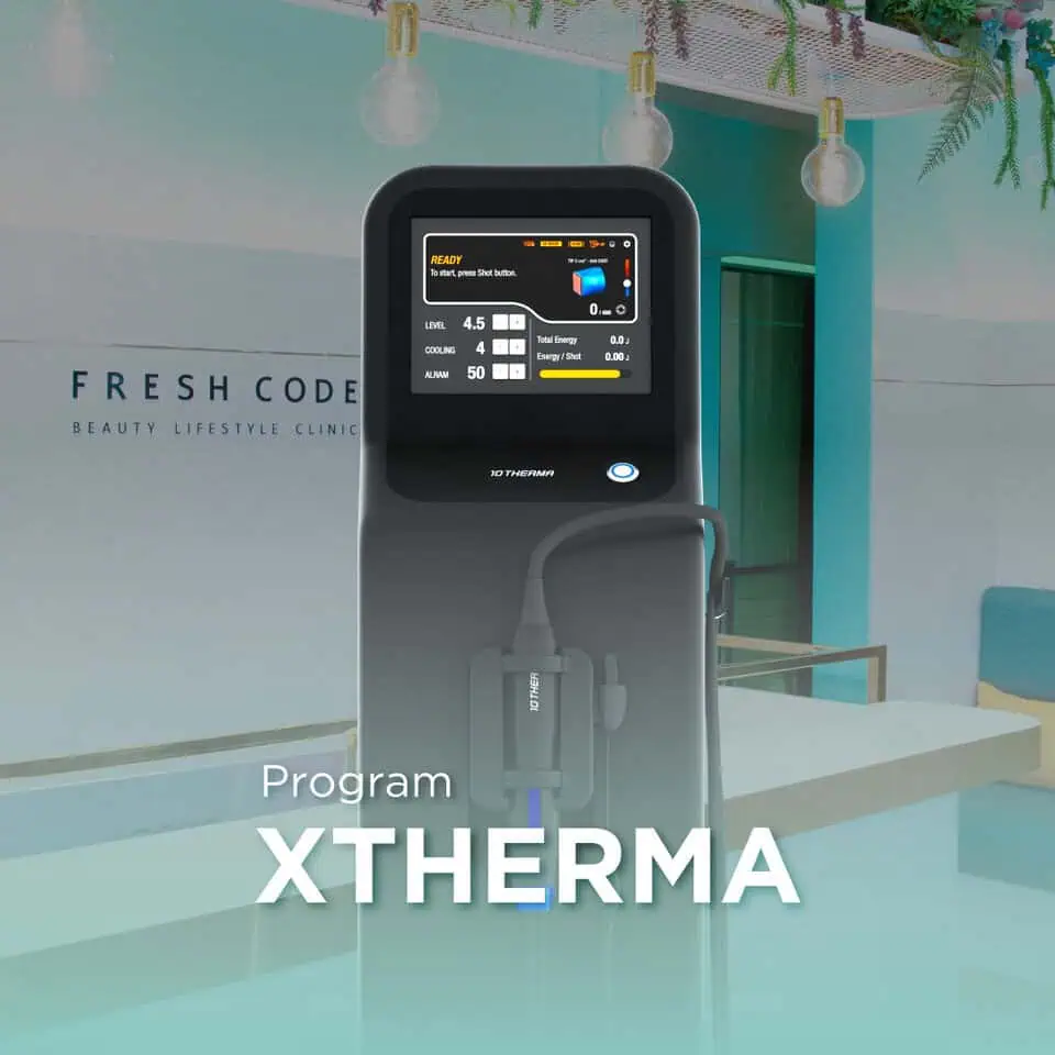 XTherma เครื่องยกกระชับผิวด้วยเทคโนโลยี Monopolar RF โดยแพทย์ผู้เชี่ยวชาญที่ Fresh Code Clinic สำหรับยกกระชับกรอบหน้า ลดความหย่อนคล้อย และกระตุ้นคอลลาเจน